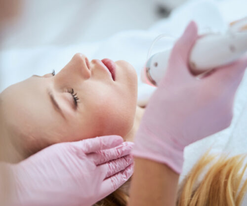 Scar treatment